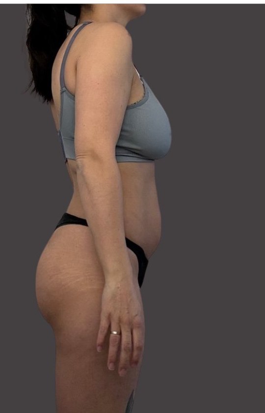 Annika na